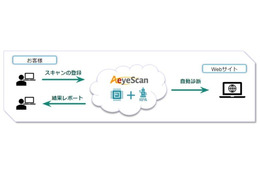 NI+C が診断自動化ツール「AeyeScan」取扱開始、Lite プランも 画像